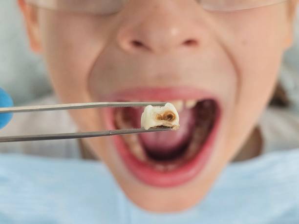 Best Orthodontic Emergency Dentist in Myrtletown, CA