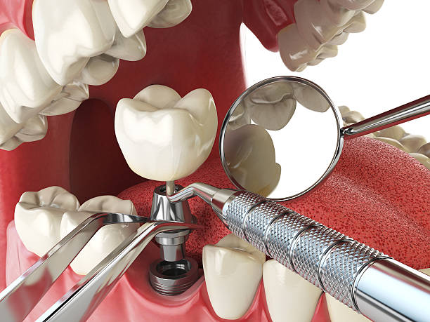 Best Holiday Emergency Dentist in Myrtletown, CA