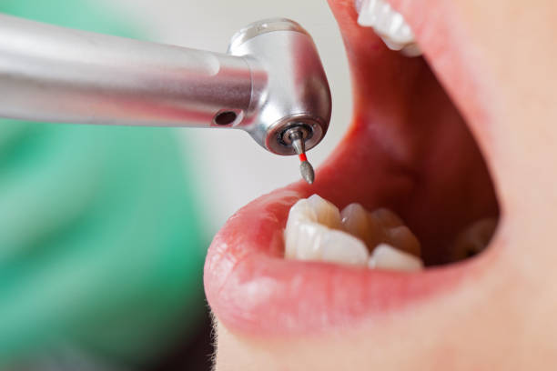 Best Emergency Dentist for Special Needs Patients in Myrtletown, CA